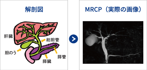 mrcp_img01.jpg