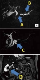 mrcp_img03.jpg