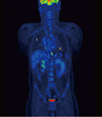 petct_img04.jpg