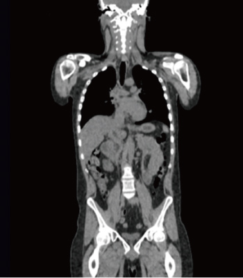 petct_img05.jpg