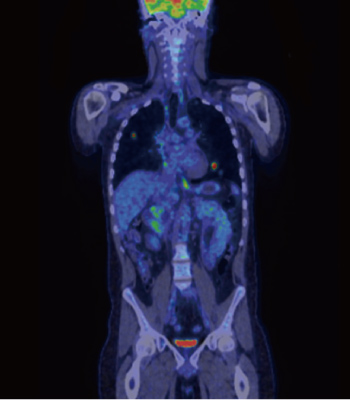 petct_img06.jpg